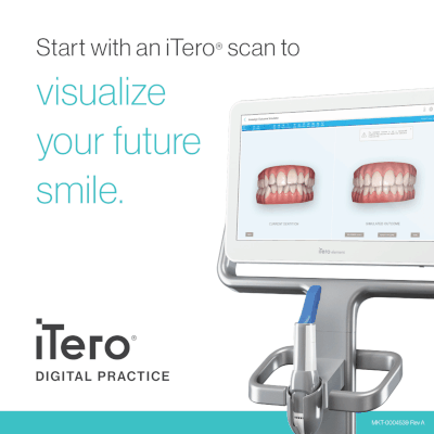 3D Digital Orthodontic Impressions