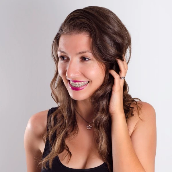 Rose Gold Braces Rose Gold Colored Braces