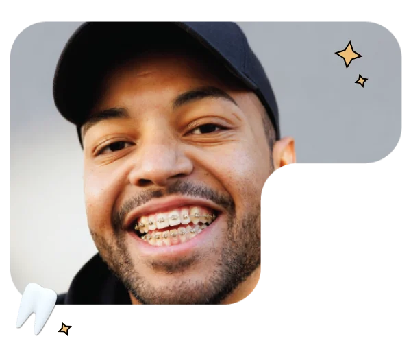 Gold Colored Braces